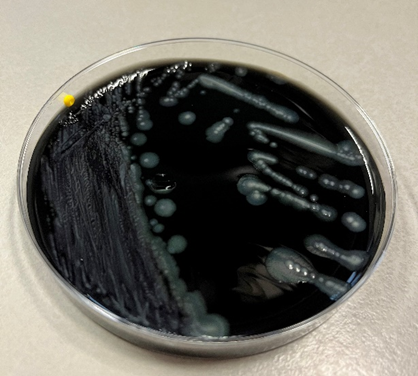 Legionella pneumophila ssp